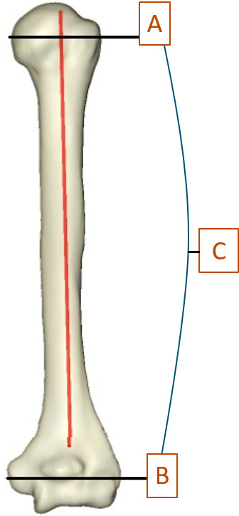 Fig. 4 
          3D image showing the greater tuberosity axis (A) and transepicondylar axis (B), between which is the greater tuberosity version angle (C).
        