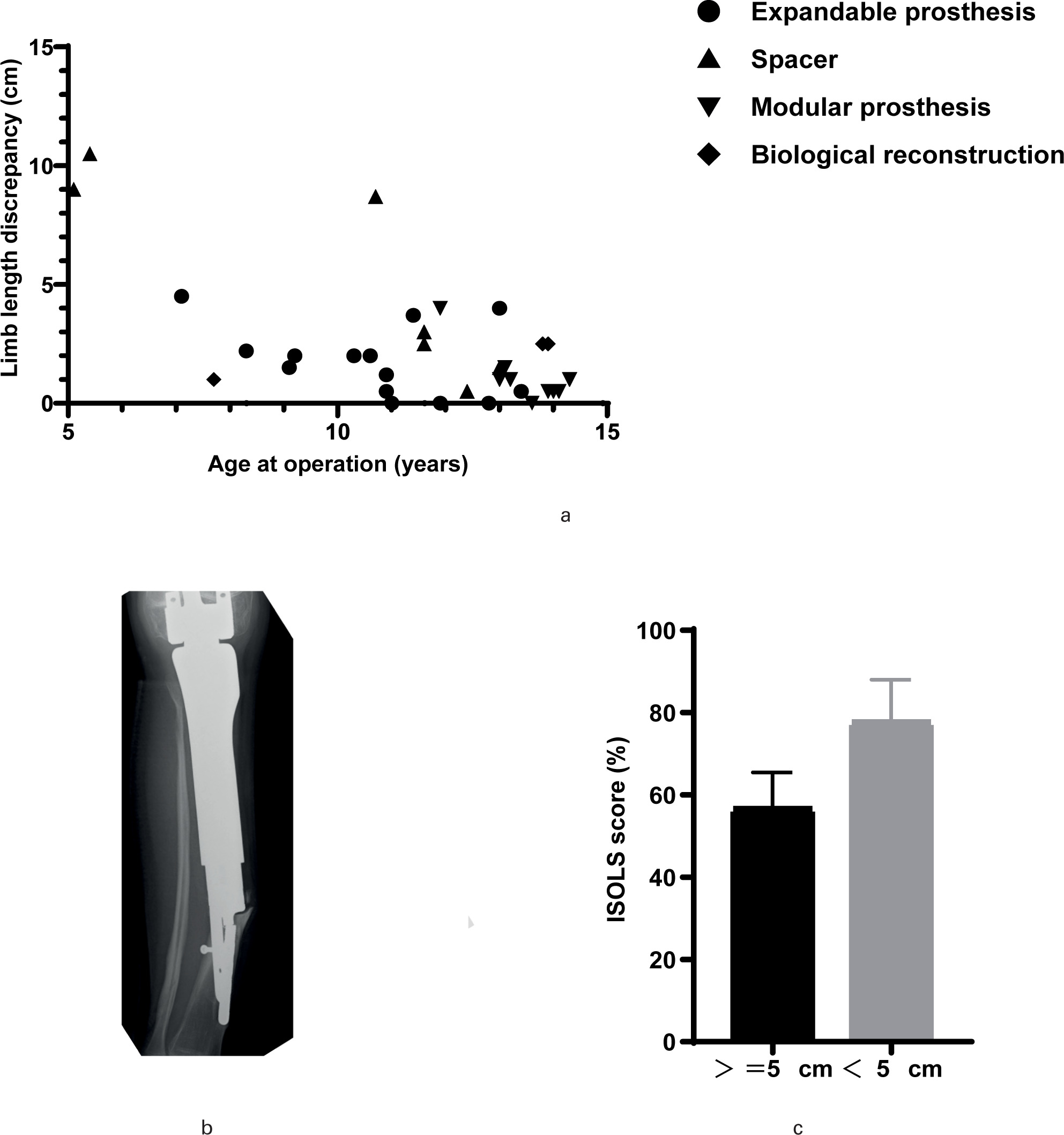 Fig. 4 
            a) Correlation between leg-length discrepancy and age at limb-sparing surgery. The leg-length discrepancy at the last follow-up is shown on the vertical axis, and the age at surgery is shown on the horizontal axis. b) A five-year-old boy underwent limb-sparing surgery and a two-step reconstruction from a spacer to an expandable prosthesis. Radiographs show a peri-stem fracture of the expandable prosthesis at age 15. c) Comparison of International Society of Limb Salvage (ISOLS) scores between cases with leg-length discrepancies ≥ 5 cm (n = 3) and those without (n = 32). The ISOLS score percentage is shown on the vertical axis. **p < 0.01.
          