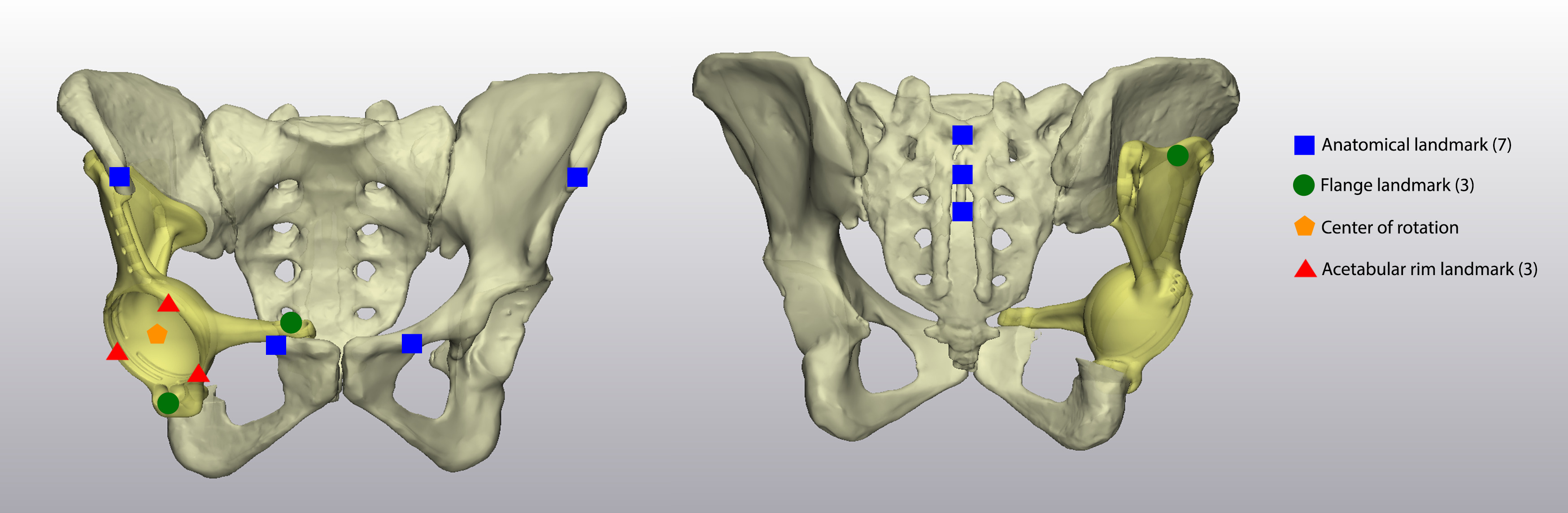 Fig. 3 
            Representation of the anatomical and implant landmark selection. Blue rectangles: anatomical landmarks on the anterior superior iliac spine, pubic tubercle, and sacrum. Green circles: implant flange landmarks. Red triangles: acetabular rim landmarks. Orange pentagon: hip centre of rotation.
          