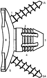 Fig. 2 
            Evaluation of the radiolucent lines. Numbers represent the zones for measurement of the radiolucent lines.
          