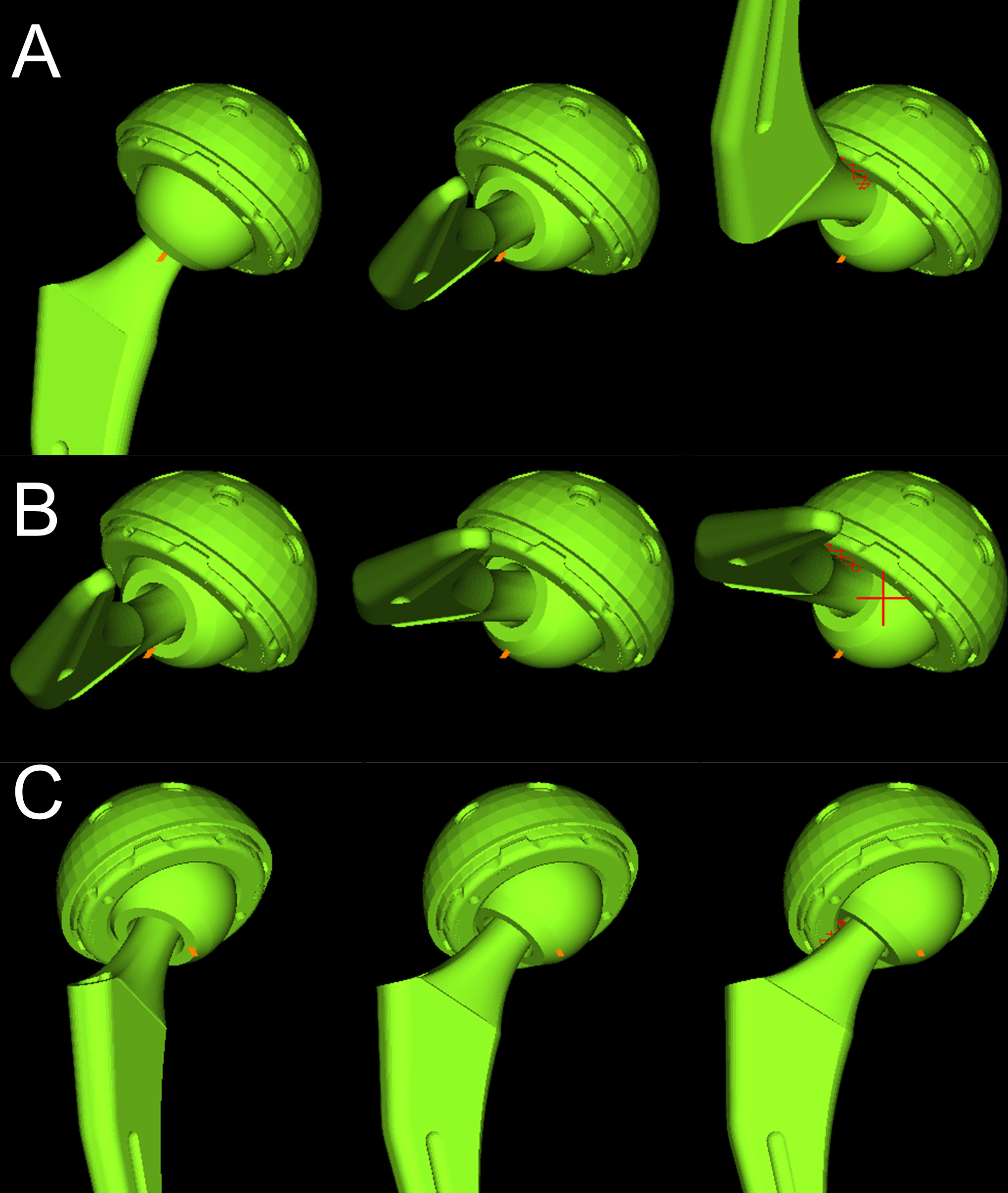 Fig. 2 
            Range of motion simulation is based on postoperative CT data using CT-based simulation software (ZedHip; Lexi, Japan). a) Flexion, b) internal rotation at 90° flexion, and c) external rotation. The red line indicates stem and cup impingements.
          